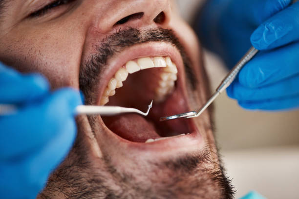 Best Cracked Tooth Emergency Dentist  in Dubuque, IA